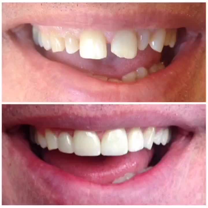 خدمات تخصصی دندانپزشکی تضمینی و اقساطی|خدمات آرایشگری و زیبایی|نیشابور, دارایی|دیوار