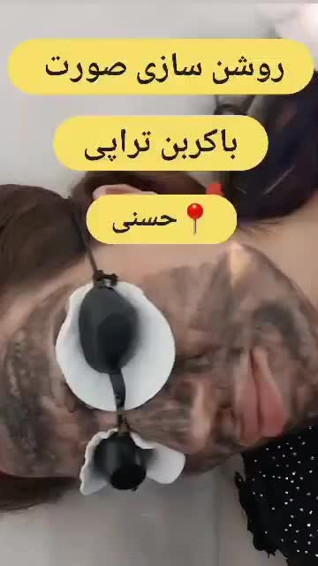 حذف تاتو با لیزر کیوسوئیچ و روشن کننده بیکینی صورت|خدمات آرایشگری و زیبایی|ارومیه, |دیوار