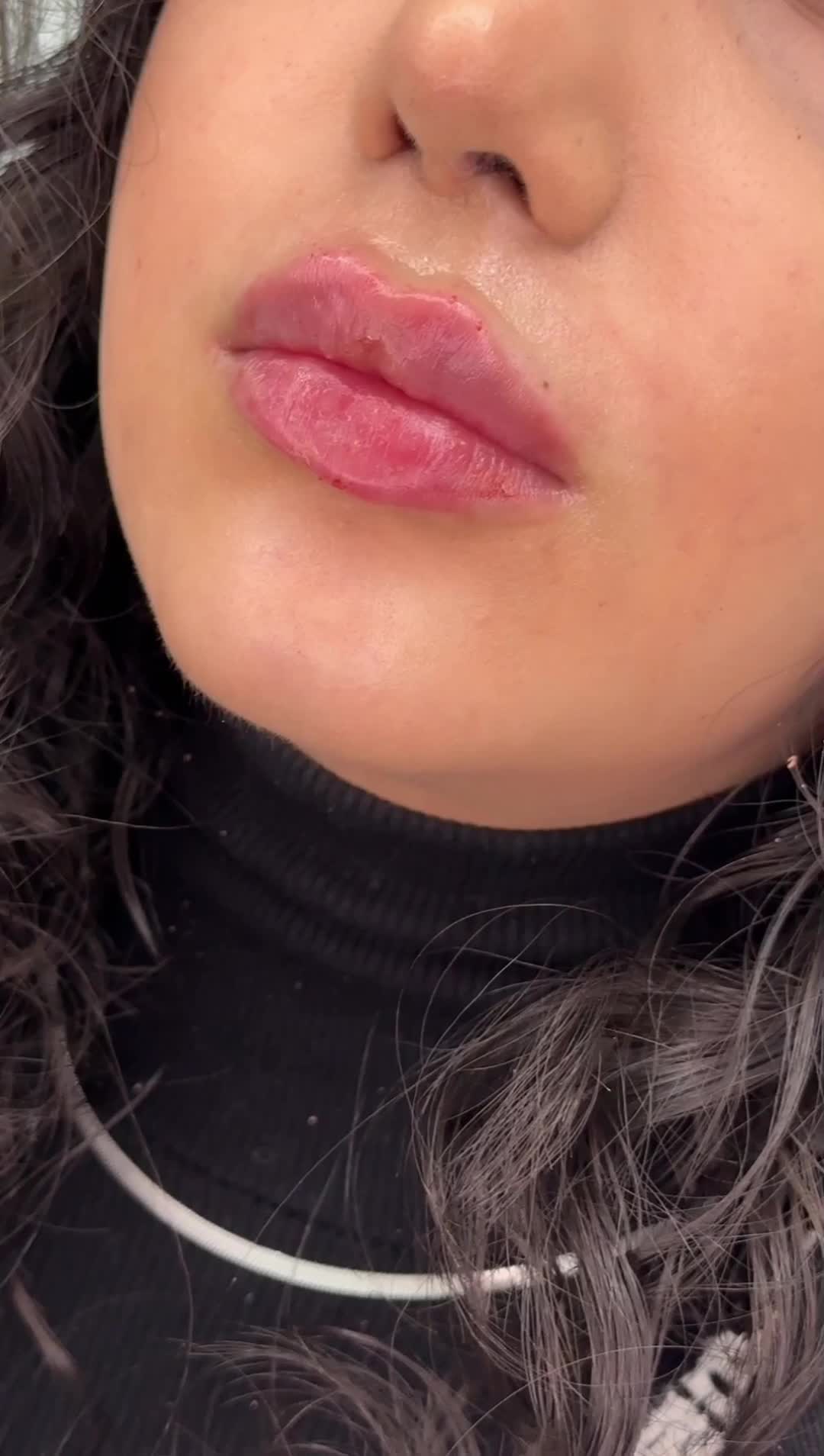 فیلر/ ژل لب تخصصی ۱.۳۰۰ ، بوتاکس پیشانی / لیفت۷۶۰|خدمات آرایشگری و زیبایی|مشهد, هدایت|دیوار