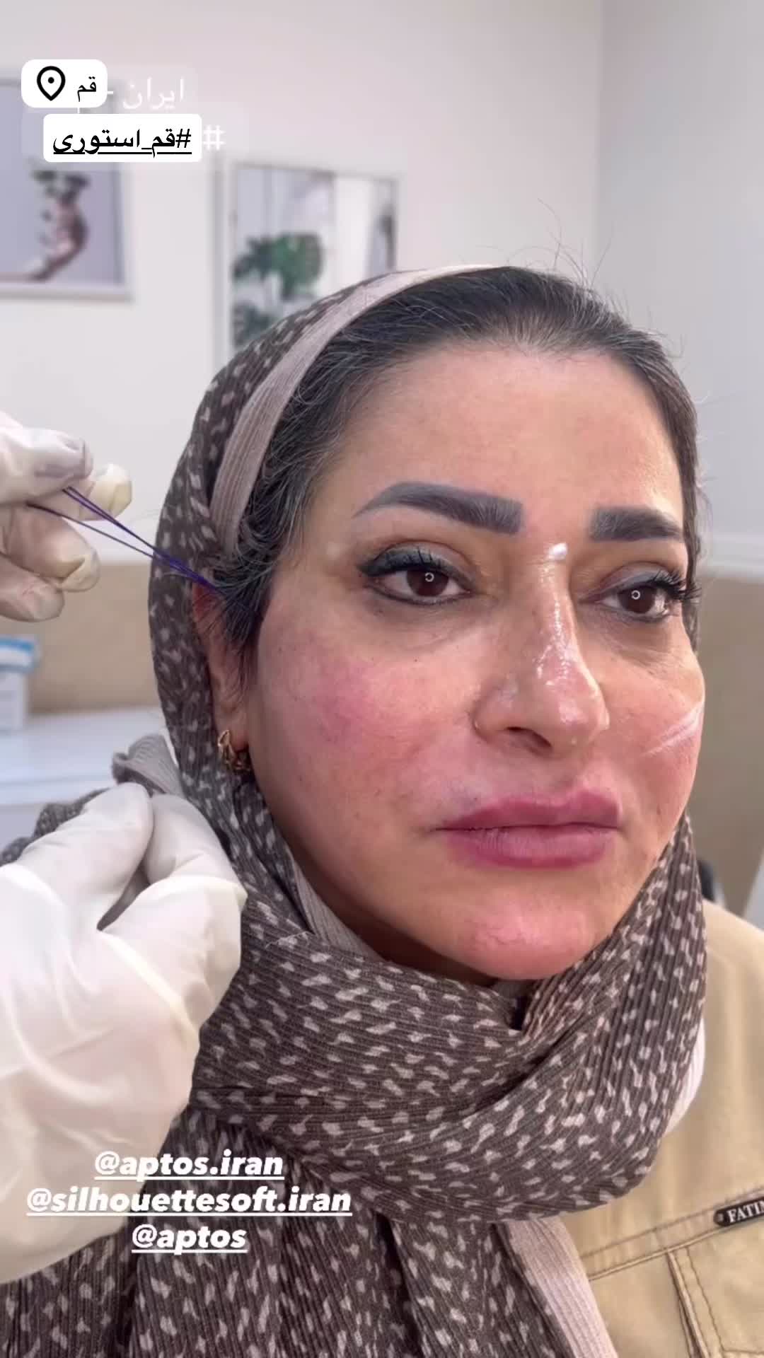 بوتاکس چشم گربه ای ۵۹۹ژللب روسی۱/۲۰۰مادلینگ۶میلیون|خدمات آرایشگری و زیبایی|قم, حاج زینل|دیوار