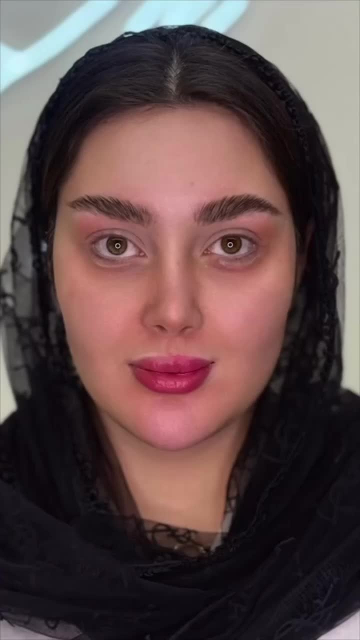 تخفیفات استثنایی ژل و بوتاکس در مطب زیبایی|خدمات آرایشگری و زیبایی|قم, دورشهر|دیوار