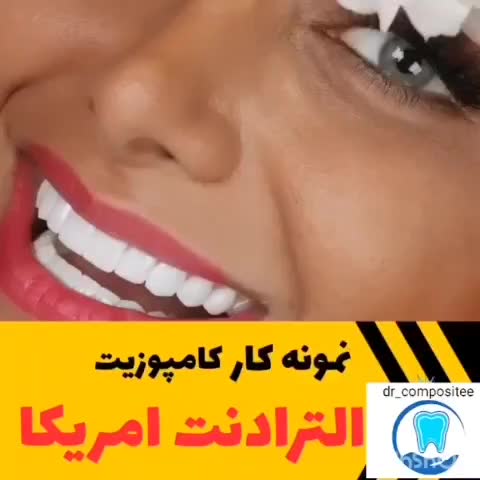 تمامی خدمات دندانپزشکی و کامپوزیت و فیسینگ|خدمات آرایشگری و زیبایی|شیراز, فرهنگ شهر|دیوار