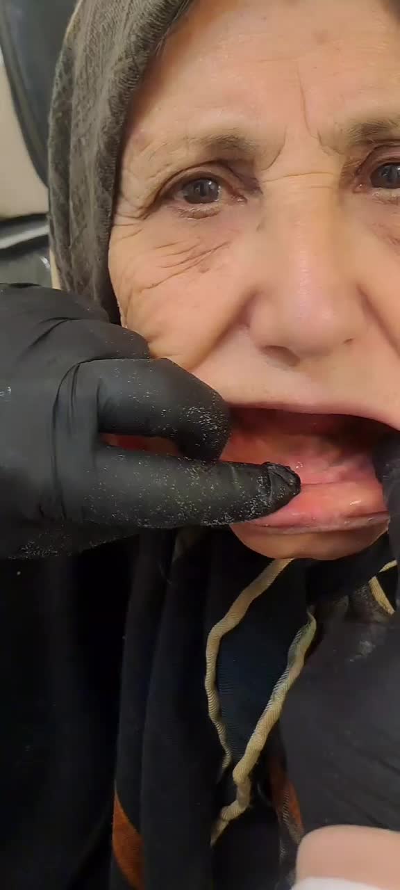 دندان مصنوعی باجدیدترین متد جهانی بدونه لقی|خدمات آرایشگری و زیبایی|شهرکرد, |دیوار