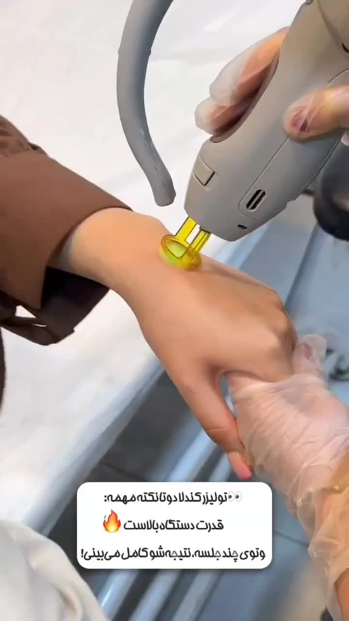 لیزرمو کندلا آمریکایی|خدمات آرایشگری و زیبایی|دهگلان, |دیوار