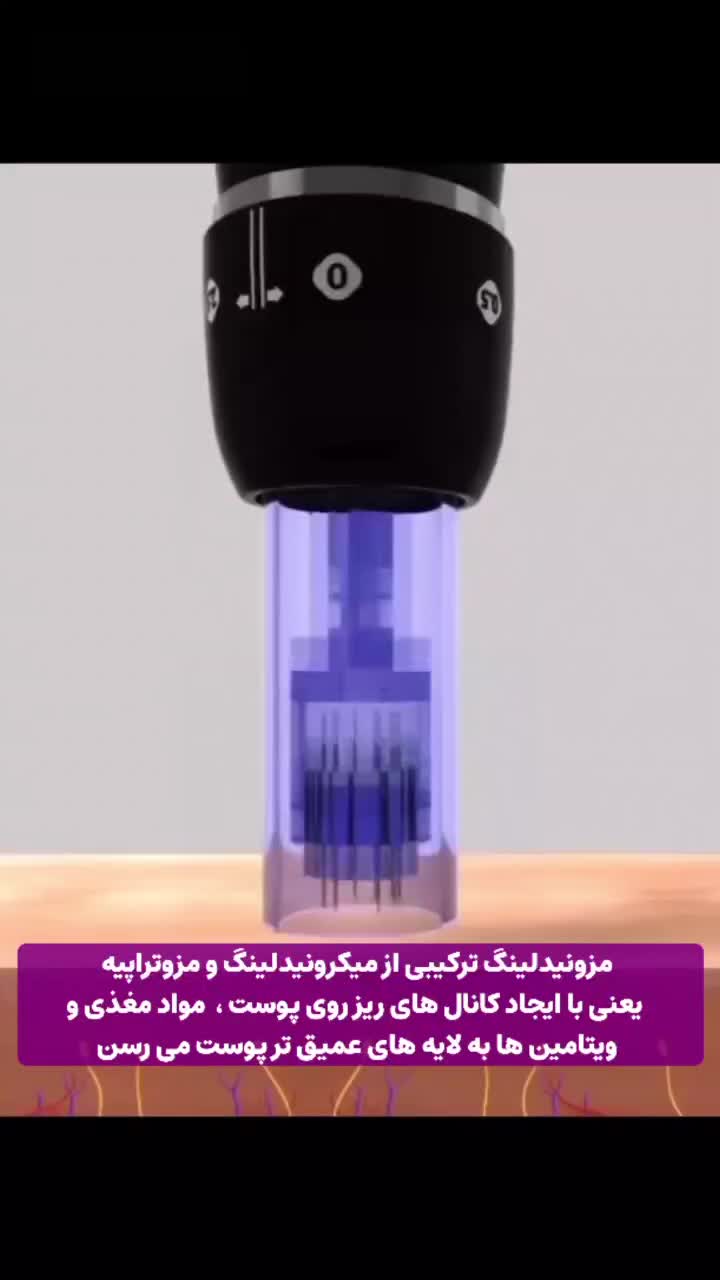 زیبایی صورتت با ما /مزونیدلینگ و PRP صورت|خدمات آرایشگری و زیبایی|دوگنبدان, |دیوار