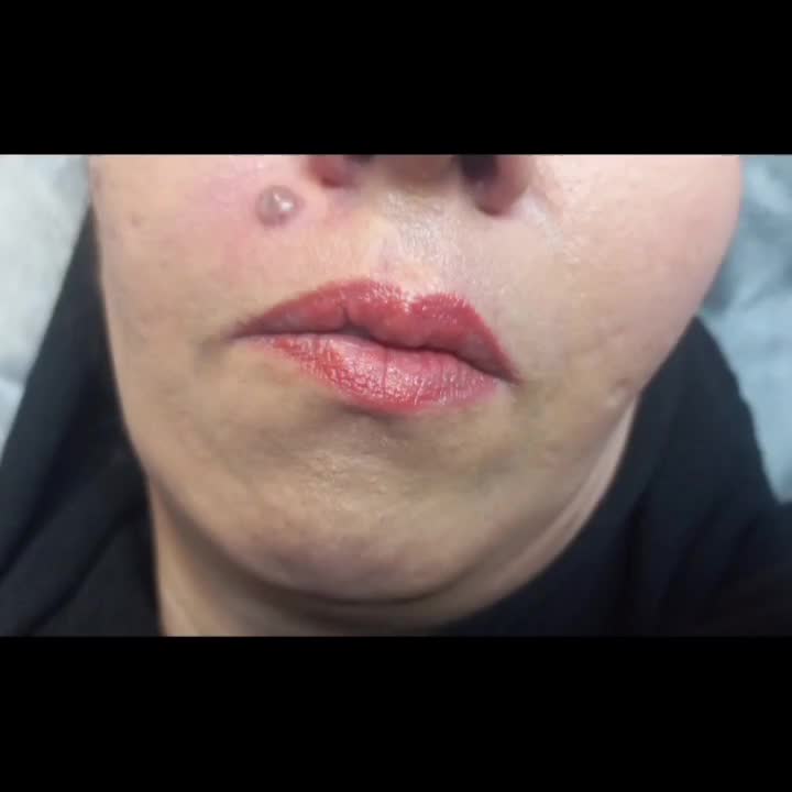 برداشتن انواع خال.جراحی غدد.جای سالک.زخم.سوختگی|خدمات آرایشگری و زیبایی|مشهد, هنرستان|دیوار