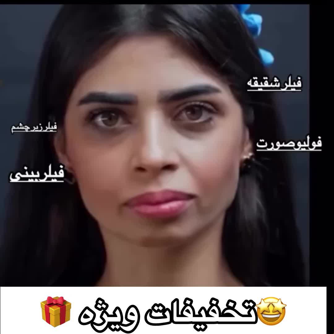 بوتاکس پیشانی،خط اخم  رایگان شد توسط پزشک|خدمات آرایشگری و زیبایی|کاشان, بهشتی|دیوار