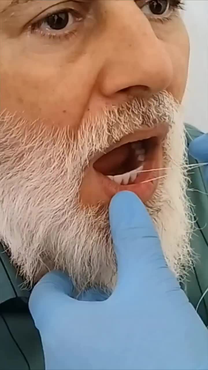 دندان مصنوعی دندانسازی حامد نصیری|خدمات آرایشگری و زیبایی|خرمآباد, |دیوار