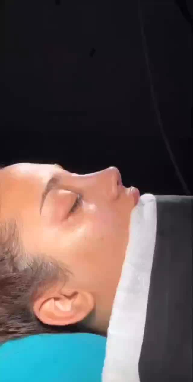 جراحی بینی عمل بینی بلفارو ساکشن غبغب لیفت صورت|خدمات آرایشگری و زیبایی|مشهد, احمدآباد|دیوار