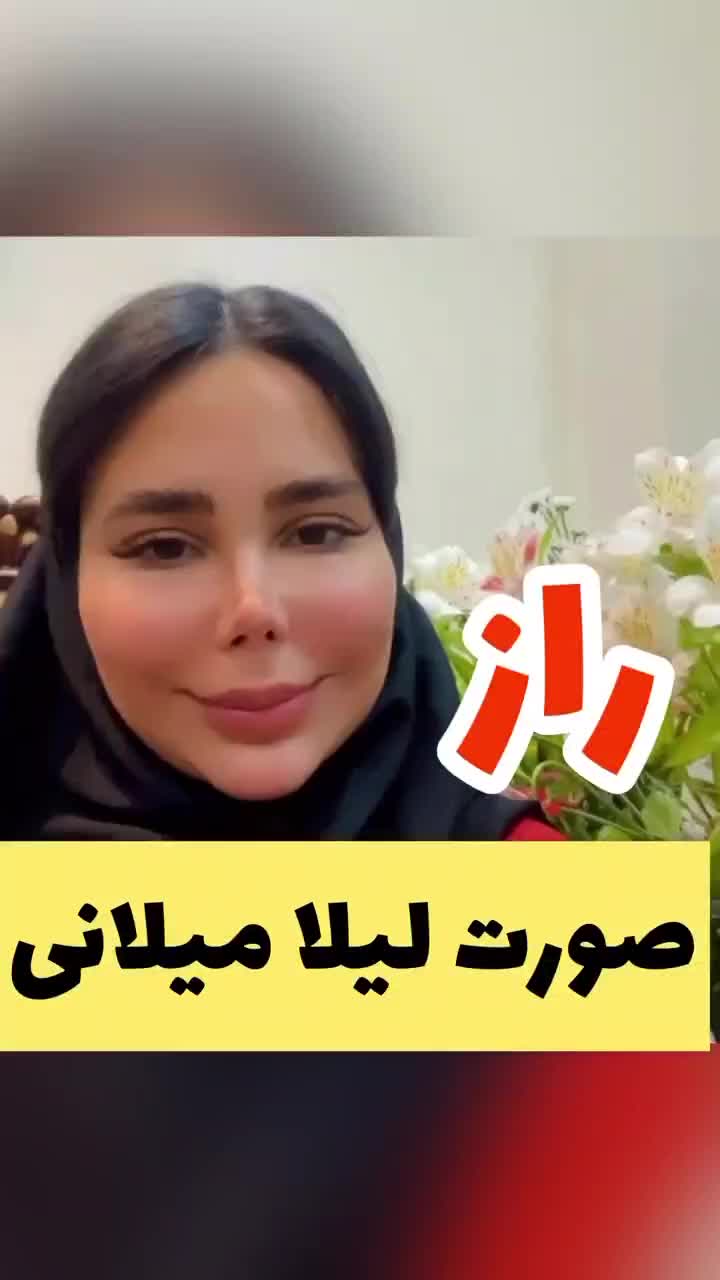 کرم بیوممتیک|آرایشی، بهداشتی، درمانی|زرند, |دیوار