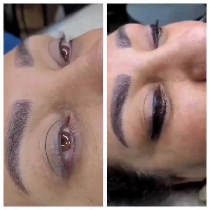 جشنواره ریمووتکجلسه بدون دردتضمینی باتخفیف۱میلیونی|خدمات زیبایی و سلامت|قم, عمار یاسر|دیوار
