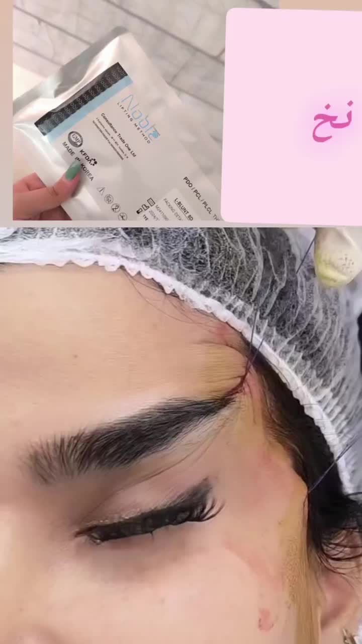 ژل بوتاکس سی سی ۵۰۰|خدمات آرایشگری و زیبایی|قرچک, میرزائی جنوبی|دیوار