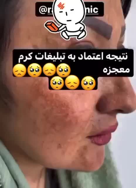 کرم ضدلک تریاک اگوستا|آرایشی، بهداشتی، درمانی|نیشابور, پاستور|دیوار