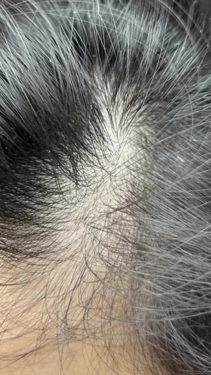 میکرواسکالپ سر/شیدینگ لب/رفع کبودی لب/بنمژه|خدمات آرایشگری و زیبایی|شیراز, معالی‌آباد|دیوار