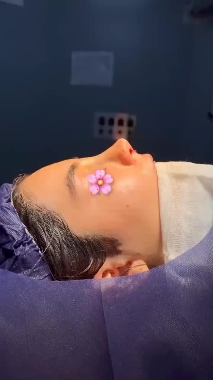 عمل بینی با قیمت باورنکردنی|خدمات آرایشگری و زیبایی|ساری, |دیوار