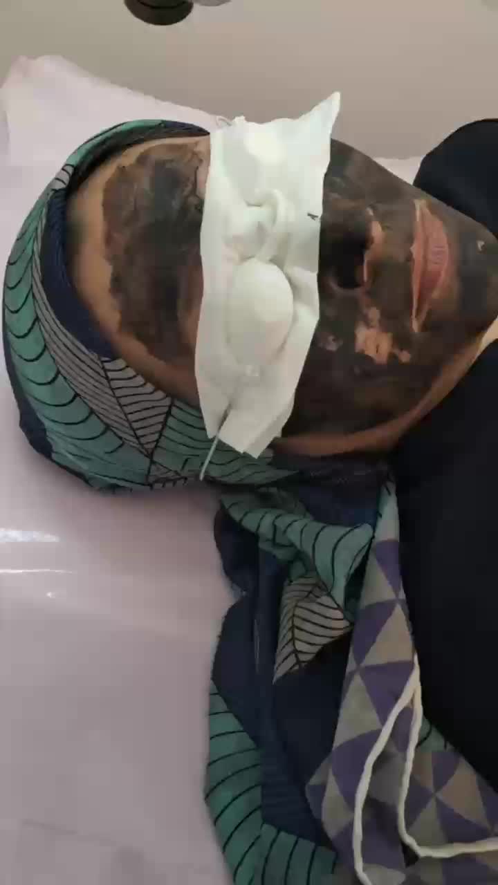 سفید سازی بکینی، جوانسازی پوست پیلینگ(کربن تراپی)|خدمات آرایشگری و زیبایی|مشهد, فرهنگیان (شهرک غرب)|دیوار