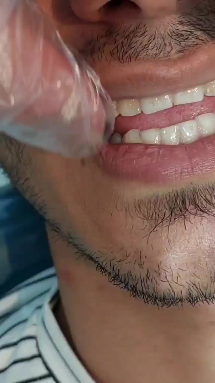 دندانپزشکی با تخفیف ٪40|خدمات آرایشگری و زیبایی|بروجرد, |دیوار