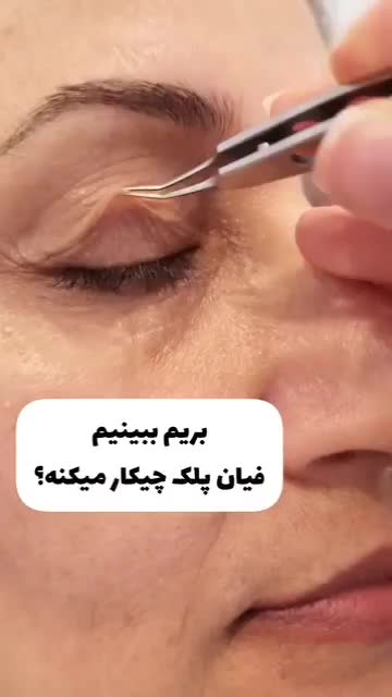 جوانسازی صورت بدون جراحی با تخفیف ویژه|خدمات آرایشگری و زیبایی|تهران, اقدسیه|دیوار