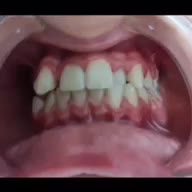 ارتودنسی کامپوزیت لمینت دندان‌مصنوعی ایمپلنت|خدمات آرایشگری و زیبایی|تهران, سلسبیل شمالی|دیوار