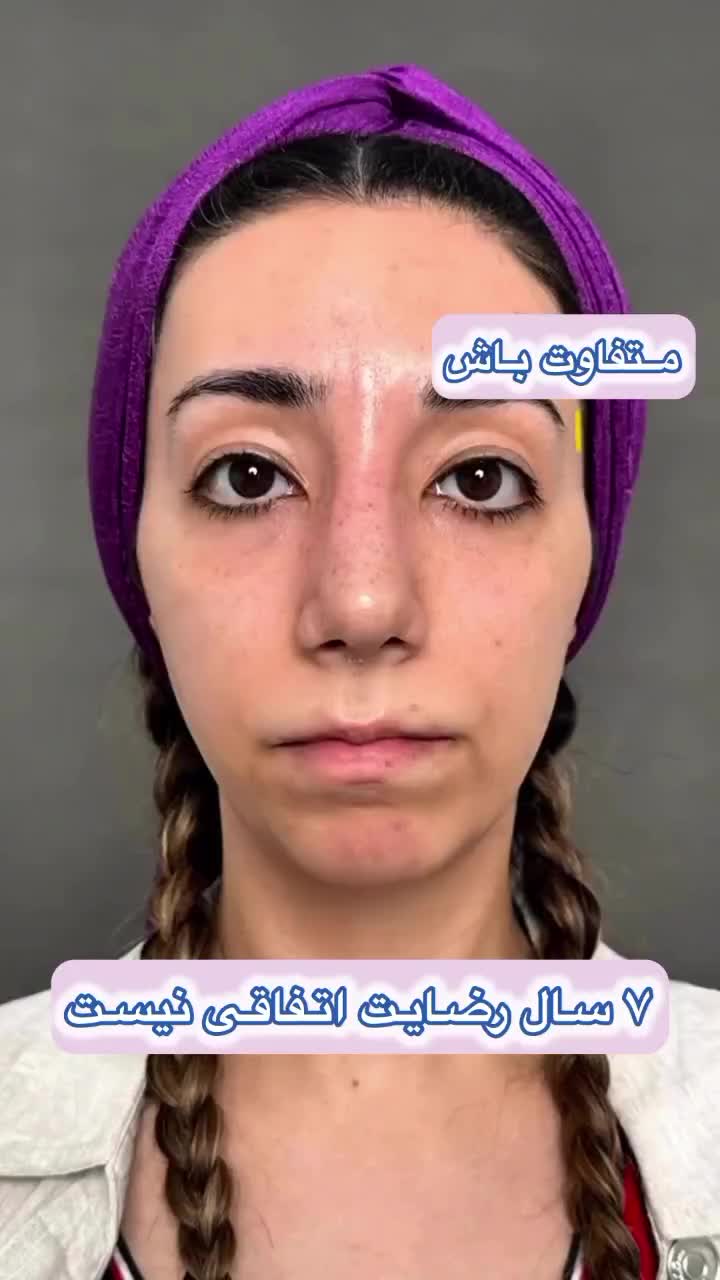 تخفیفات ۴۰ درصدی دکتر کاظمی ژل و بوتاکس فیلر مزو|خدمات آرایشگری و زیبایی|مشهد, کوثر|دیوار
