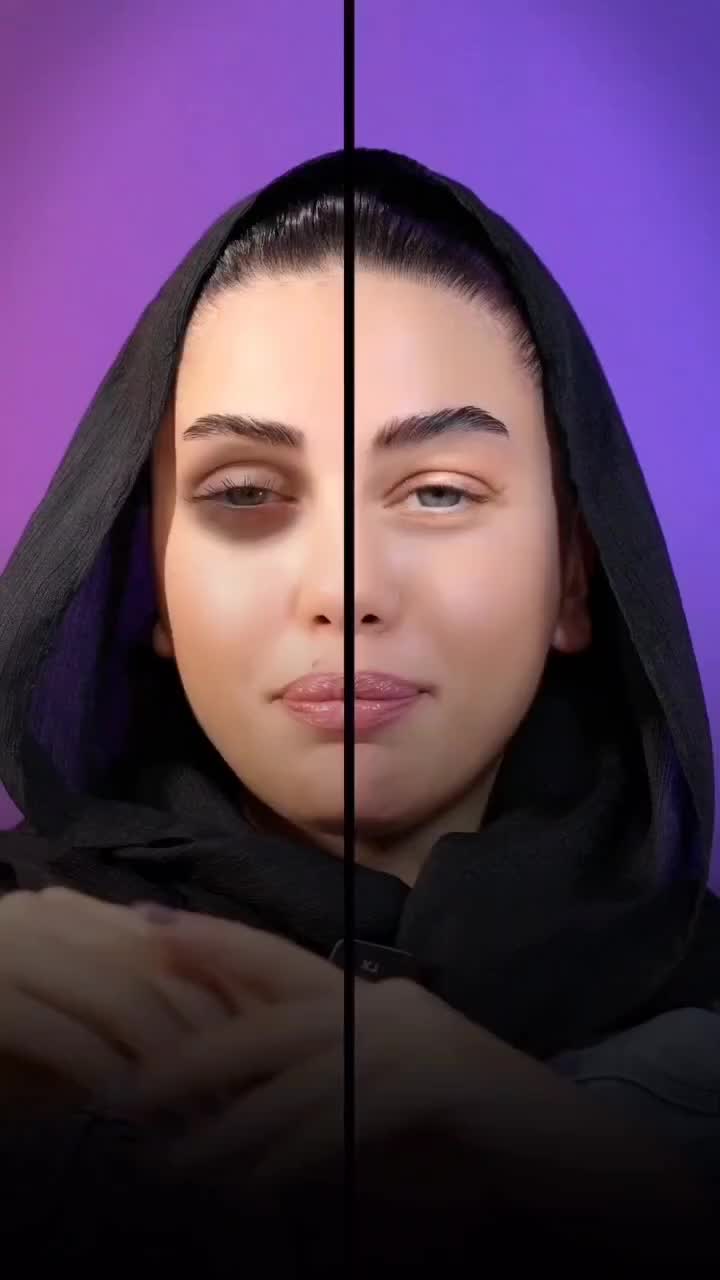 جشنواره لیفت اروپایی چشم پلک ابرو بینی بدون بیهوشی|خدمات آرایشگری و زیبایی|مشهد, هفت تیر (حافظ)|دیوار