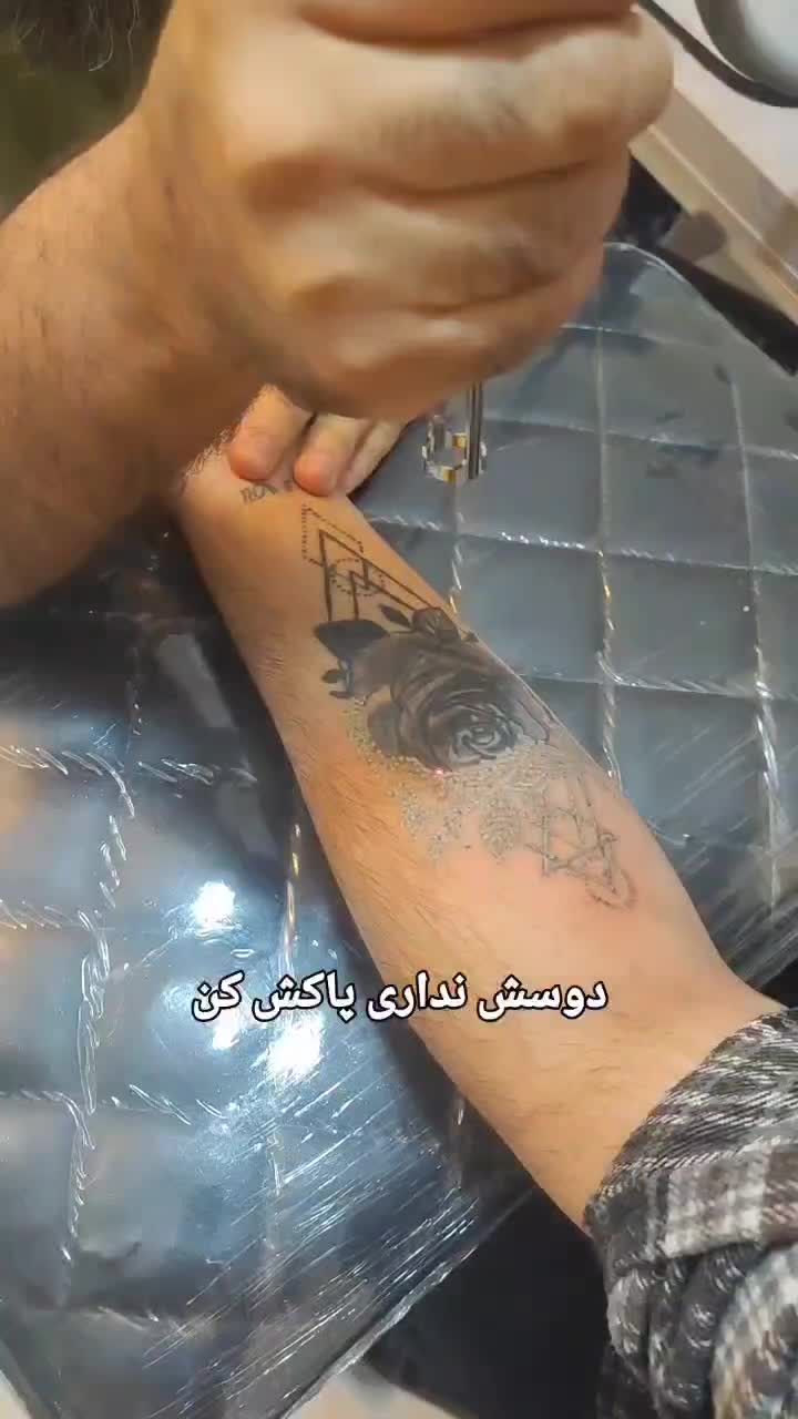 ریمو تتو.جوانسازی پوست. کربن تراپی. کربکسی تراپی|خدمات آرایشگری و زیبایی|کرمانشاه, |دیوار