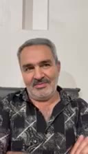 دندان مصنوعی ، فیلیپر ، تکی|خدمات زیبایی و سلامت|تهران, باغ فیض|دیوار