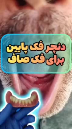 انواع‌ دندان متحرک حرفه ای طرح لمینیت و... باضمانت|خدمات آرایشگری و زیبایی|تهران, ائمه اطهار|دیوار