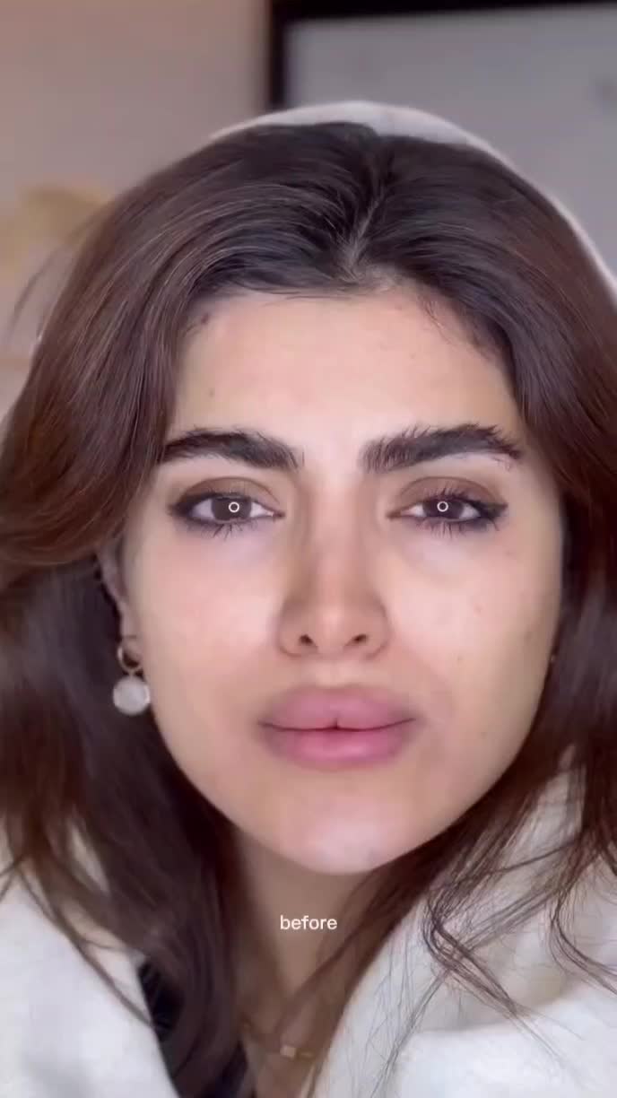 جشنواره یلدایی ژل لب کانتورینگ مزوژل لیفت صورت|خدمات آرایشگری و زیبایی|تهران, تهرانپارس جنوبی|دیوار