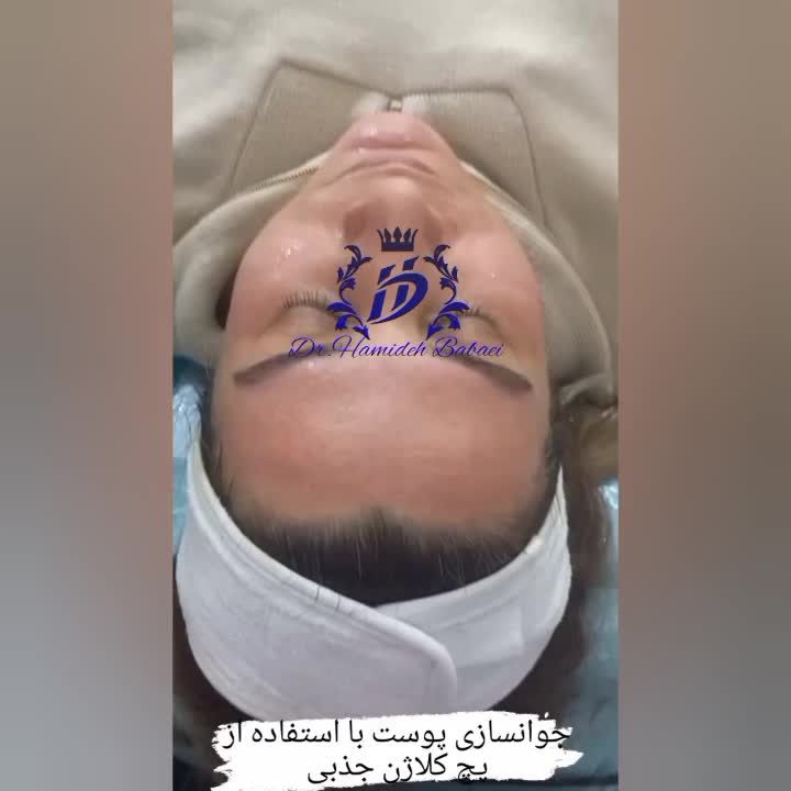 آموزش فیشال،فیشیال، فشیال، تخصصی درمانی،مزونیدلینگ|خدمات آموزشی|تهران, جنت‌آباد مرکزی|دیوار