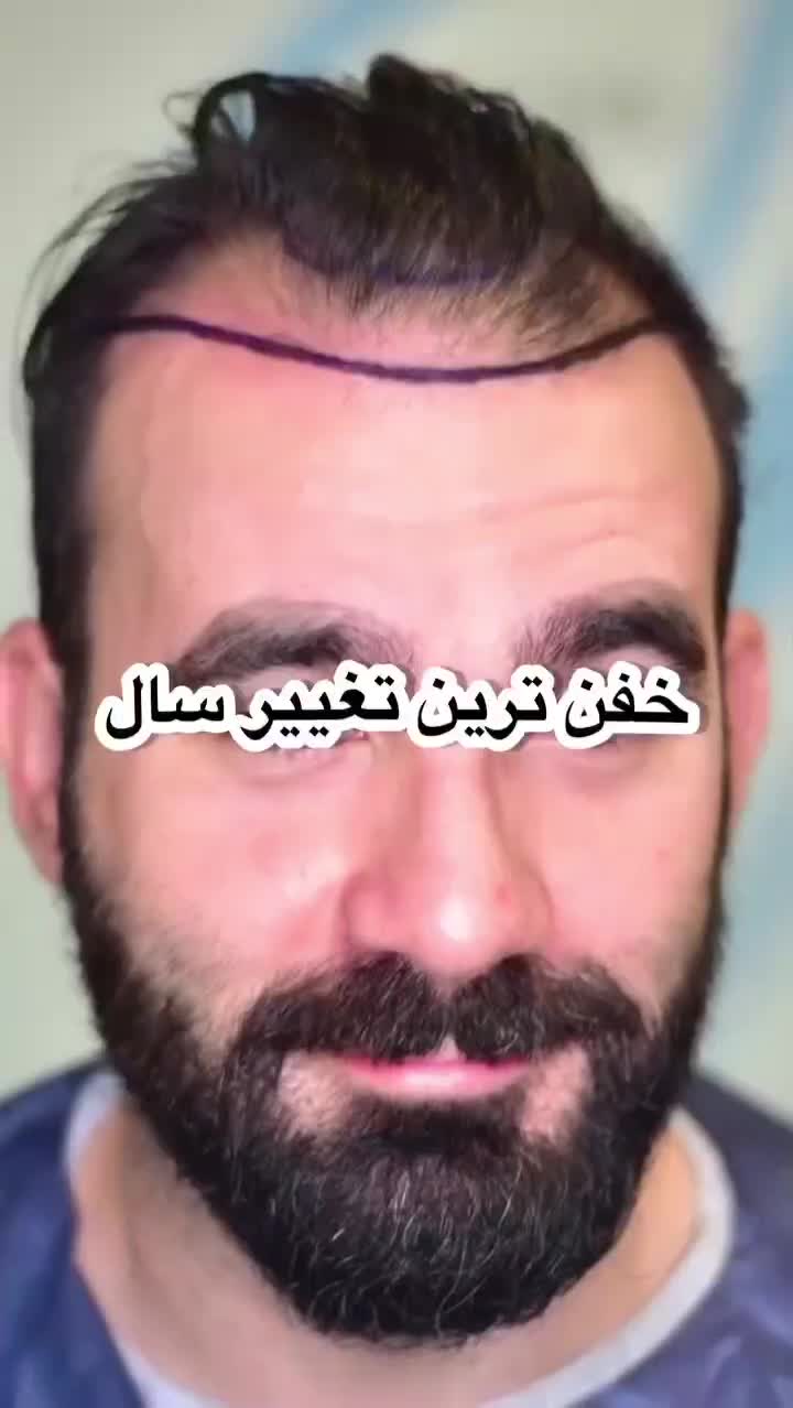 کاشت مو ابرو بلفاروپلاستی مزو تراپی پی آرپی|خدمات آرایشگری و زیبایی|تهران, صادقیه|دیوار