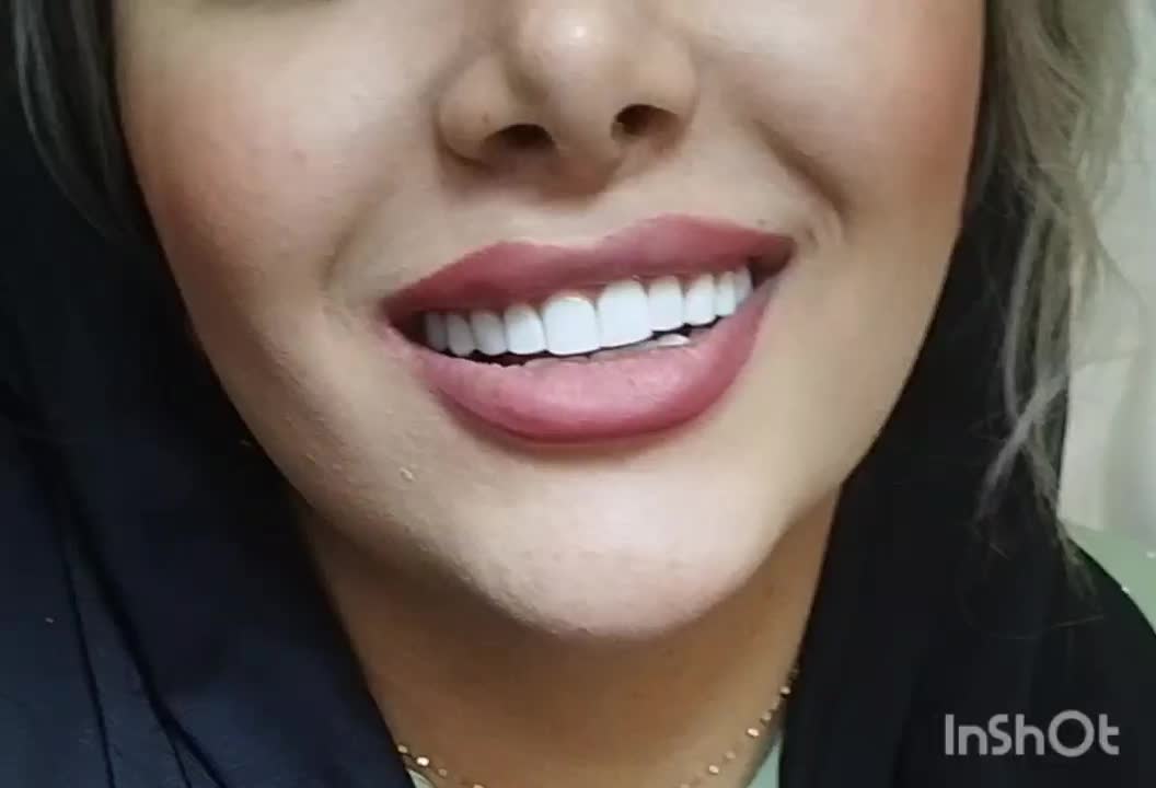 کامپوزیت *vip*|خدمات آرایشگری و زیبایی|خرم‌آباد, |دیوار