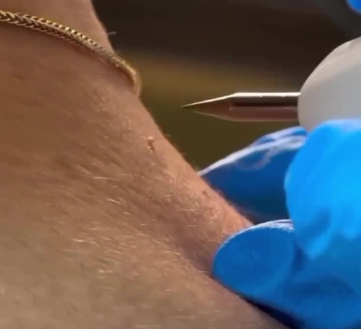 برداشتن لک و کک و مک|خدمات آرایشگری و زیبایی|نورآباد, |دیوار