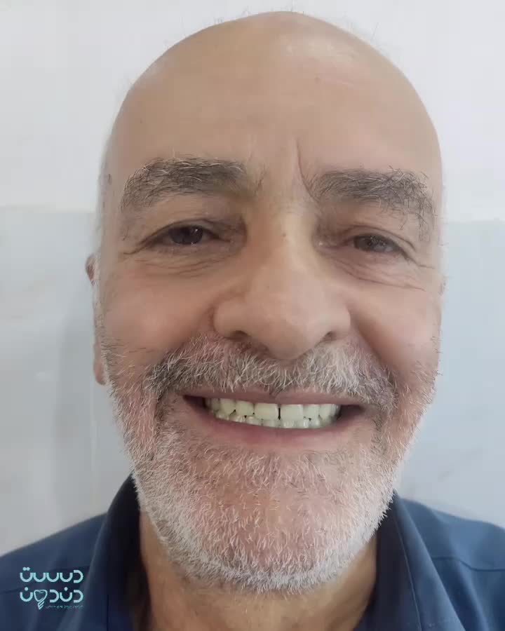 دندانسازی ،دندان مصنوعی،دندان،باضمانت وتحویل فوری|خدمات آرایشگری و زیبایی|مشهد, طلاب|دیوار