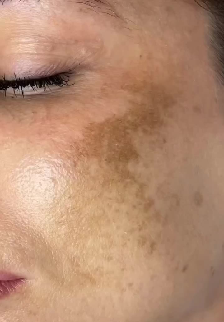 روشن کننده صورت و دست معجزه بشرط اصلی و گیاهی|آرایشی، بهداشتی، درمانی|یاسوج, |دیوار