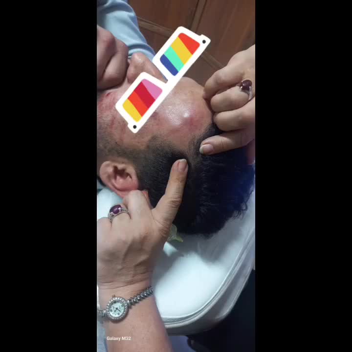 پاک کردن رد عمل.ابدو.لیپو.خودزنی.ترک شکم وبدن|خدمات آرایشگری و زیبایی|مشهد, هنرستان|دیوار