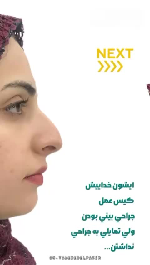 خالبرداری،حذف تاتو با لیزر و تمامی تزریقات زیبایی|خدمات آرایشگری و زیبایی|شیراز, گلدشت معالی‌آباد|دیوار