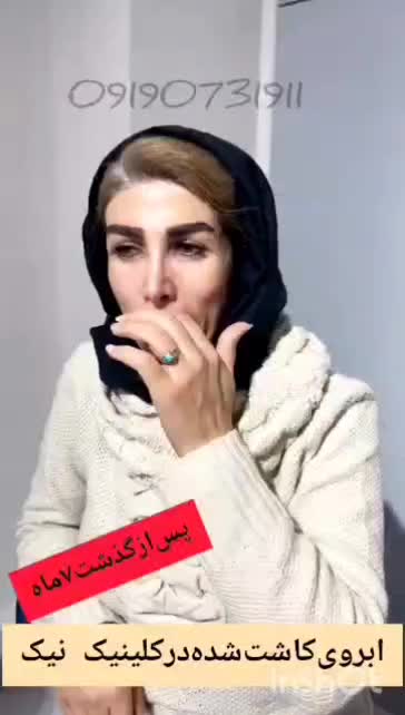 جشنواره کاشت ابرو تراکم بالا،با جراحی و بدون جراحی|خدمات آرایشگری و زیبایی|تهران, باغ فیض|دیوار