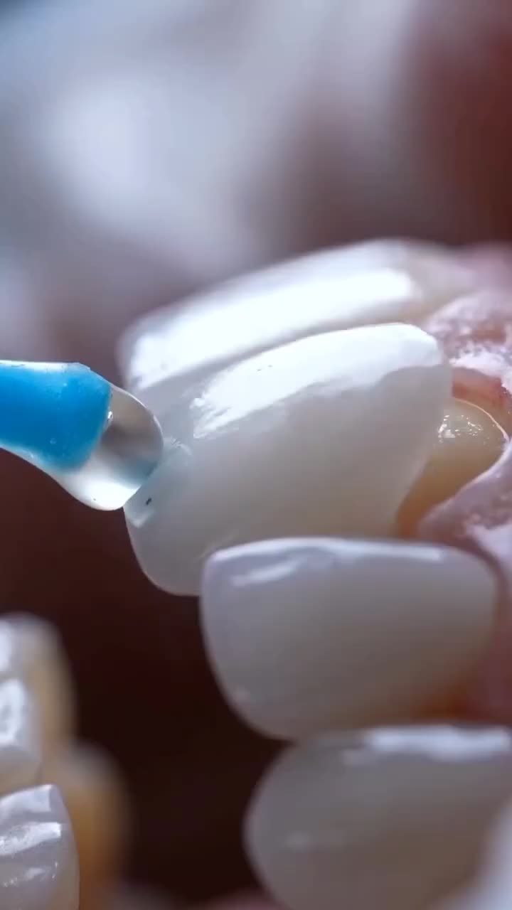 کامپوزیت، لمینت، ایمپلنت دندان اقسا*طی|خدمات آرایشگری و زیبایی|مشهد, شریف|دیوار