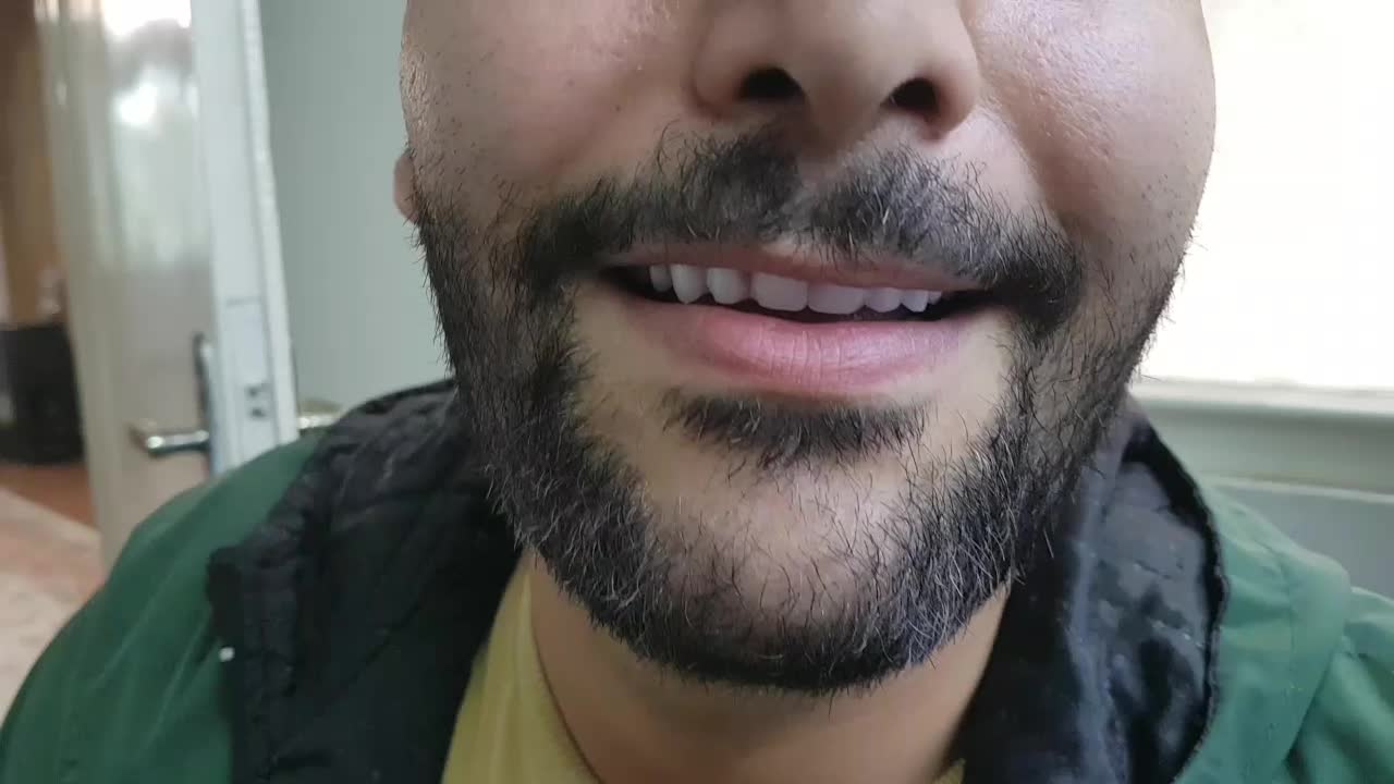 دندان مصنوعی با ضمانت(تکه ای،طرح لمینت) ارتودنسی|خدمات آرایشگری و زیبایی|تهران, نیروی هوایی (پیروزی)|دیوار