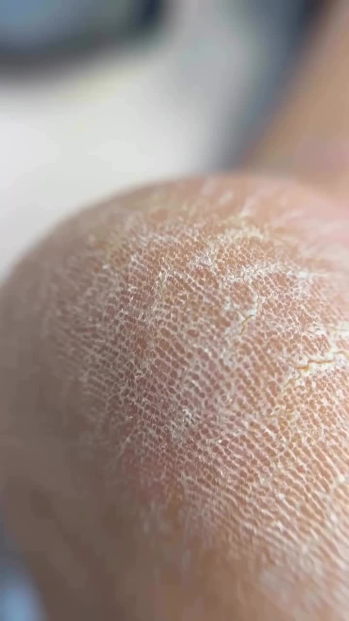 تخفیف بلک‌فرایدی برای ناخن و پدیکور پا|خدمات آرایشگری و زیبایی|رشت, دیلمان|دیوار