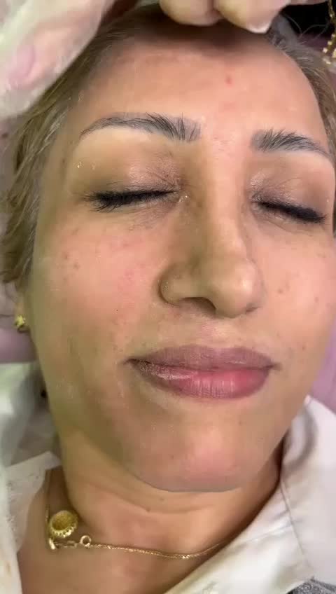 خدمات تخصصی پوست|خدمات آرایشگری و زیبایی|کرج, کوی کارمندان جنوبی|دیوار