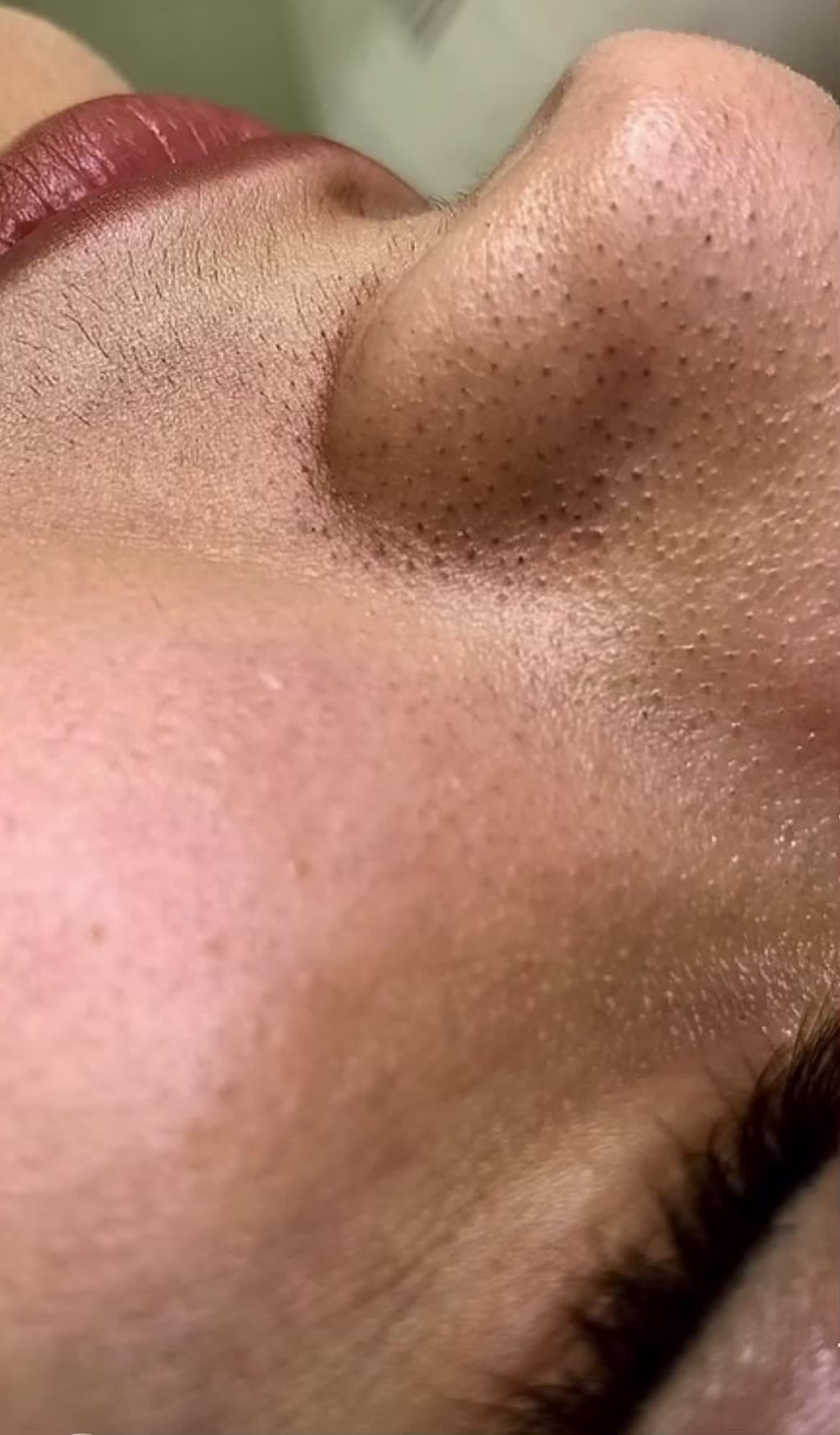 فیشال تخصصی با دستگاههای کلینیکی ،مشاوره رایگان|خدمات زیبایی و سلامت|مشهد, صیاد شیرازی|دیوار