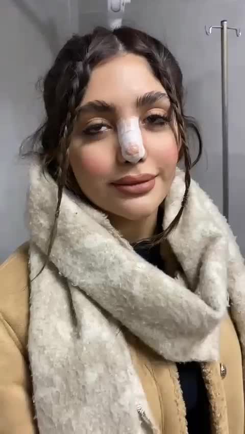 جشنواره عمل بینی جراحی بینی با ده تومن پیش|خدمات آرایشگری و زیبایی|تهران, فلسطین (میدان انقلاب)|دیوار