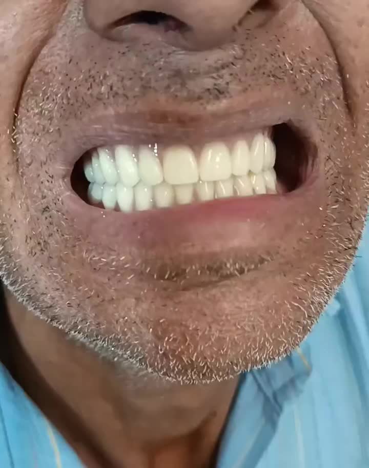 پروتز دندان (دندان مصنوعی)|خدمات آرایشگری و زیبایی|تربت‌حیدریه, بازار|دیوار