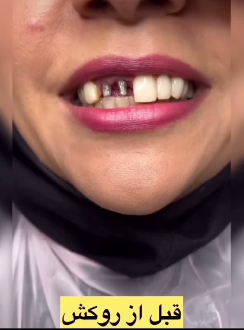 زیبایی دندان و ترمیم و درمان تخصصی|خدمات آرایشگری و زیبایی|ملارد, |دیوار