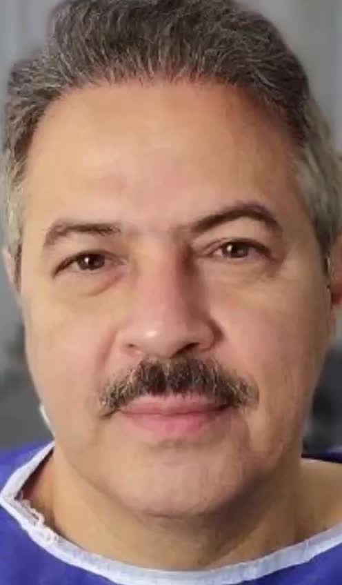 کاشت مو فقط در یک روز با ضمانت تراکم|خدمات آرایشگری و زیبایی|اصفهان, کشاورزی|دیوار