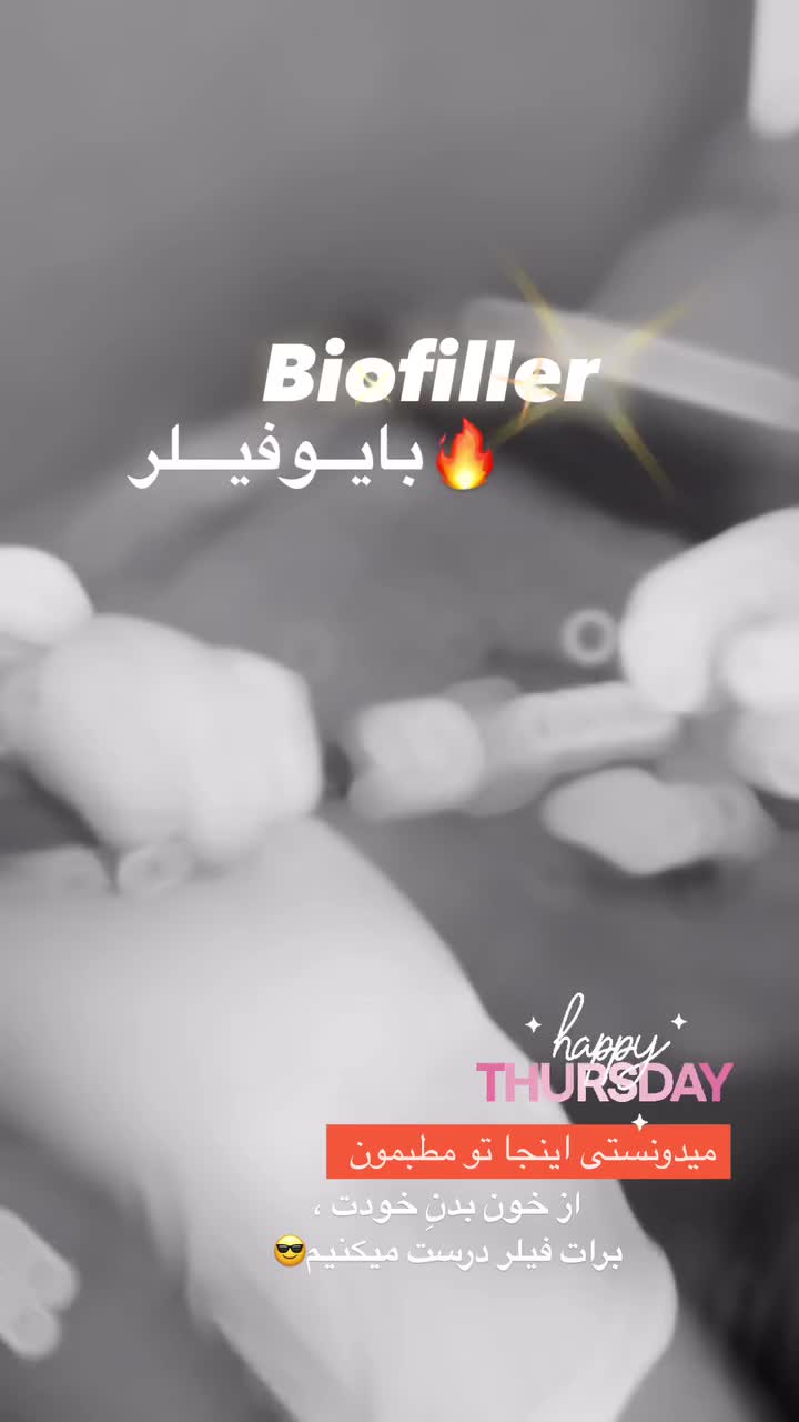 جشنواره تزریق ژل و فیلر بوتاکس کانتورینگ توسط پزشک|خدمات آرایشگری و زیبایی|سنندج, |دیوار