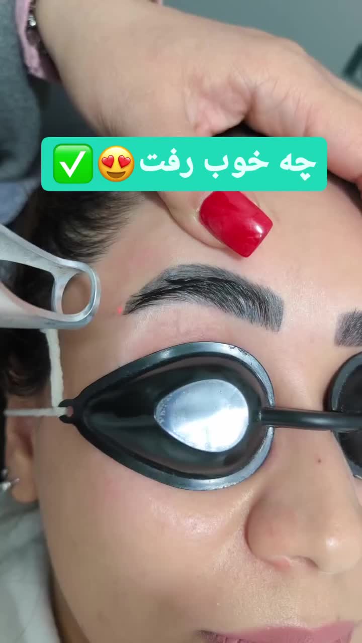 پاک کردن انواع تاتو با لیزر پیشرفته کیوسوئیچ|خدمات آرایشگری و زیبایی|اهواز, کیانپارس |دیوار
