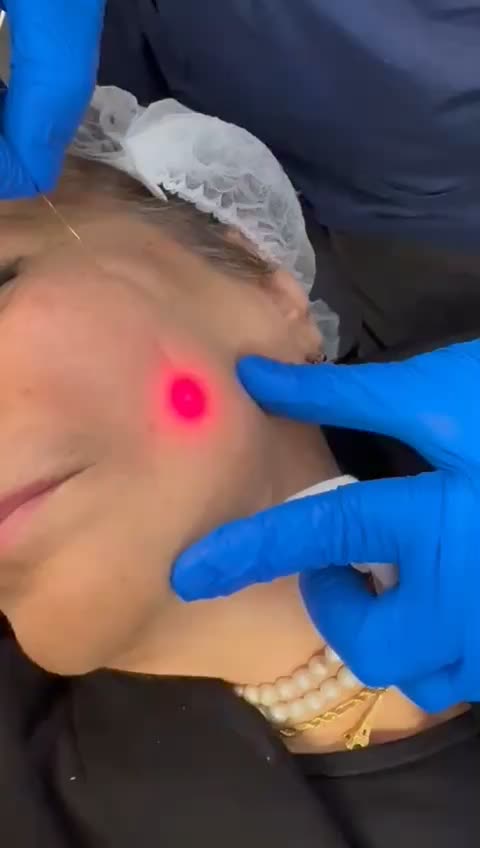 جشنواره اگزوزوم، فیلر بادی نخ،ژل،پی ارپی|خدمات آرایشگری و زیبایی|تهران, سعادت‌آباد|دیوار